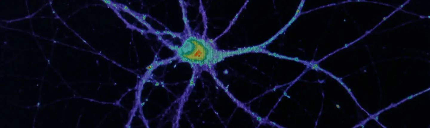 banner-grupo-investigacion-enfermedad-alzheimer
