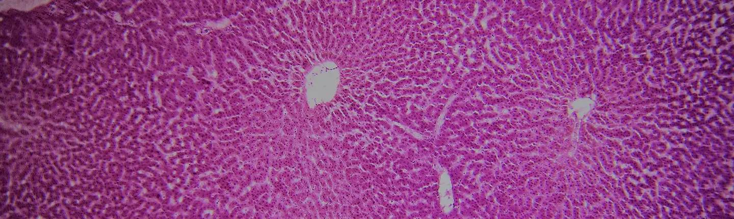banner-histologia-higado