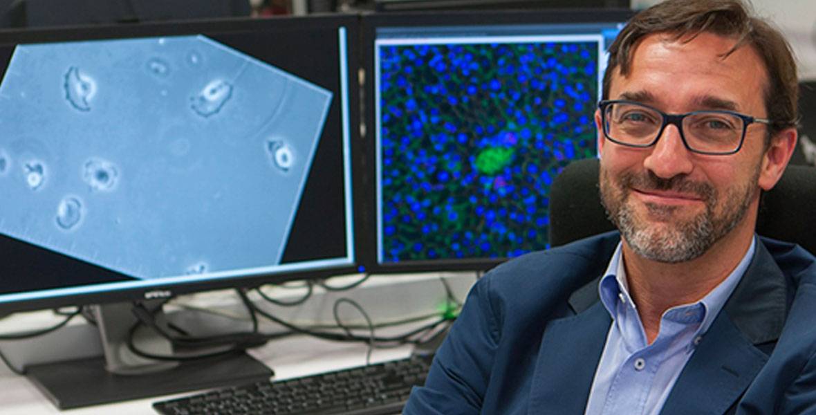Seguimiento automático de las células para conocer las alteraciones implicadas en el cáncer