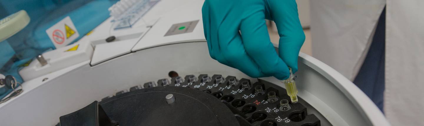 img-destacado-analisis-bioquimico-cobas