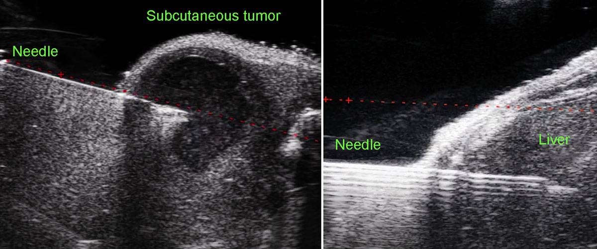 microinyeccion-guiada-terapias-celulares-vevo3100