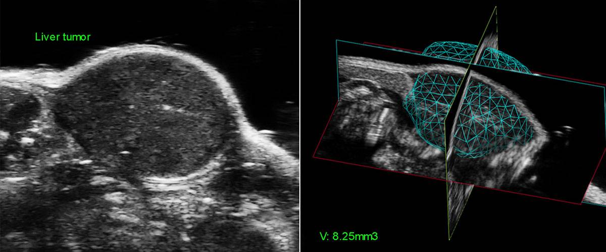 tumores-abdominales-eco3d-vevo-3100