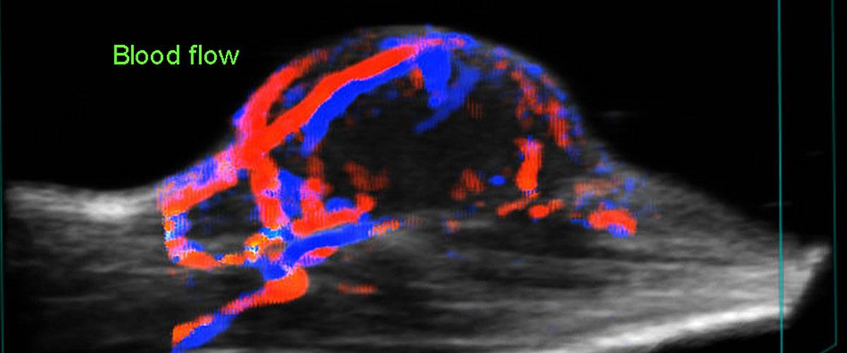 vaculatura-accesoria-tumor-vevo3100