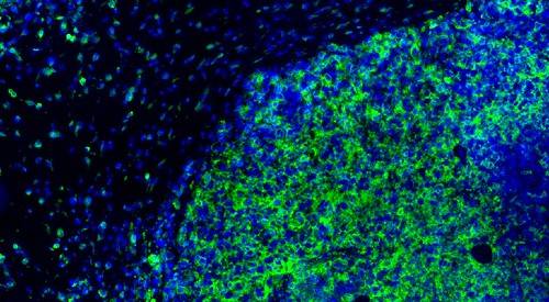 img-destacado-tumor-inmunofluorescencia