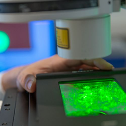 img-destacado-microscopio-confocal