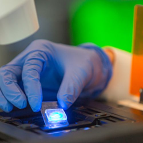 img-destacado-microscopio-multifoton