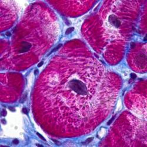 img-destacado-enfermedades-cardiovasculares