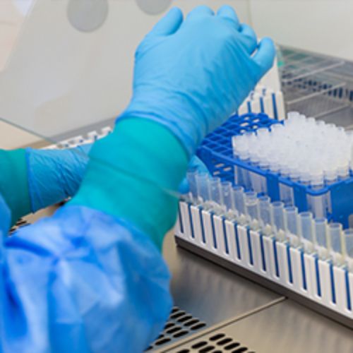 img-destacado-muestras-laboratorio