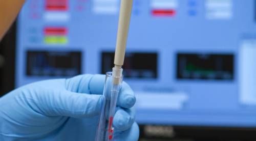 img-detalle-labo-biopsia